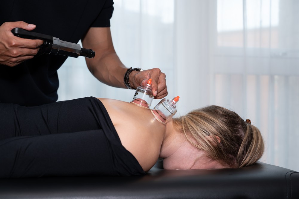 Cupping therapy being applied to a patient's upper back and shoulder